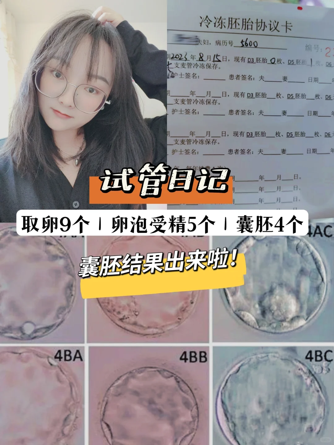 试管日记｜一分钟教会你看胚胎等级‼️,代孕什么地方做的最权威-国内供卵最快的医院